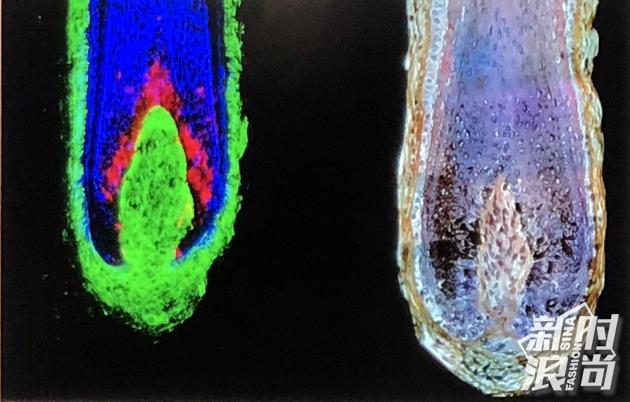Hair grows in hair cysts.
